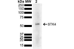 Western blot analysis of Human Cervical cancer cell line (HeLa) lysate showing detection of 55. (STK4 抗体  (AA 320-420) (HRP))