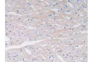 IHC-P analysis of Rat Heart Tissue, with DAB staining. (Cholecystokinin 抗体  (AA 1-115))