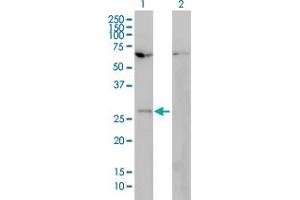 Western Blot analysis of HOXB7 expression in transfected 293T cell line by HOXB7 monoclonal antibody (M01), clone 4F9.