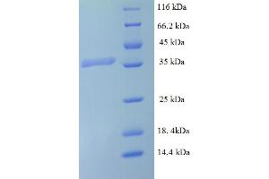 SDS-PAGE (SDS) image for Leptin (LEP) (AA 88-294) protein (His-SUMO Tag) (ABIN5711241)