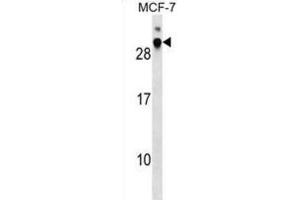 Western Blotting (WB) image for anti-Microvascular Endothelial Differentiation Gene 1 Protein (DNAJB9) antibody (ABIN2999789) (DNAJB9 抗体)