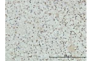 Image no. 1 for anti-Androgen Receptor (AR) (AA 221-321) antibody (ABIN598541) (Androgen Receptor 抗体  (AA 221-321))