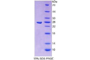 SDS-PAGE analysis of Human CBFb Protein. (CBFB 蛋白)