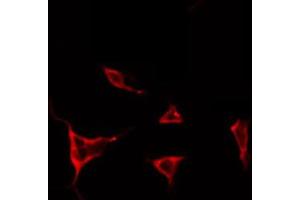 ABIN6266662 staining NIH-3T3 by IF/ICC. (TIMP4 抗体  (C-Term))