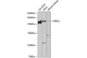 Western blot analysis of extracts of various cell lines, using MRC2 antibody (ABIN6129049, ABIN6143990, ABIN6143991 and ABIN6225189) at 1:1000 dilution. (MRC2 抗体  (AA 120-300))