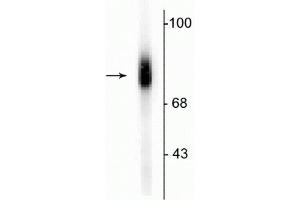 Western blot of human adrenal medulla lysate showing specific immunolabeling of the ~75 kDa DBH protein. (DBH 抗体  (C-Term))