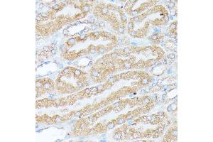 Immunohistochemistry (IHC) image for anti-Ribosomal Protein L7 (RPL7) (AA 1-248) antibody (ABIN6147148)