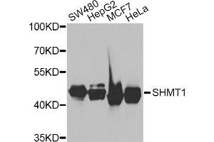 Western blot analysis of extracts of various cell lines, using SHMT1 antibody (ABIN5975171) at 1/1000 dilution. (SHMT1 抗体)