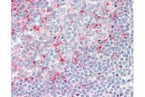 Anti-LILRB2 / ILT4 antibody IHC staining of human tonsil.