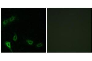 Immunofluorescence analysis of A549 cells, using MARK2 antibody. (MARK2 抗体  (N-Term))