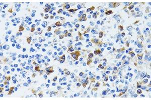 Immunohistochemistry of paraffin-embedded Human tonsil using CD63 Polyclonal Antibody at dilution of 1:100 (40x lens). (CD63 抗体)