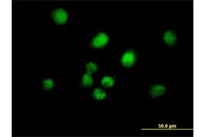Immunofluorescence of purified MaxPab antibody to MAD2L1BP on HeLa cell. (MAD2L1BP 抗体  (AA 1-306))