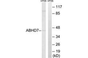 Western blot analysis of extracts from HT-29 cells, using ABHD7 Antibody. (EPHX4 抗体  (AA 101-150))