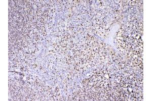 IHC analysis of PAX5 using anti-PAX5 antibody . (PAX5 抗体  (AA 217-282))