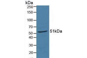 Detection of RARa in Porcine Liver Tissue using Polyclonal Antibody to Retinoic Acid Receptor Alpha (RARa)
