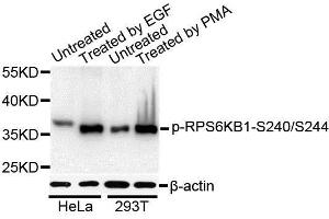 Western blot analysis of extracts of various cell lines, using Phospho-RPS6KB1-S240/244 antibody. (RPS6 抗体  (pSer240, pSer244))