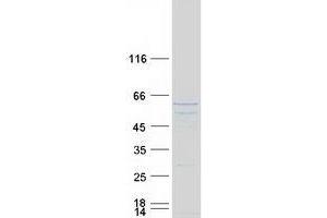 Validation with Western Blot (TSSC1 Protein (Myc-DYKDDDDK Tag))