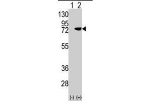 Western blot analysis of PRKCD (arrow) using rabbit PRKCD polyclonal antibody . (PKC delta 抗体  (N-Term))