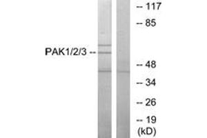 Western blot analysis of extracts from NIH-3T3 cells, using PAK1/2/3 (Ab-423/402/421) Antibody. (PAK1/2/3 抗体  (AA 391-440))