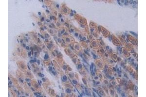 Immunohistochemistry (IHC) image for anti-Proprotein Convertase Subtilisin/kexin Type 1 (PCSK1) (AA 244-530) antibody (ABIN7443446)