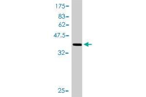 Western Blot detection against Immunogen (41. (TXNL4A 抗体  (AA 1-142))
