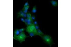 Image no. 2 for anti-Melan A (MLANA) antibody (ABIN1499425) (MLANA 抗体)