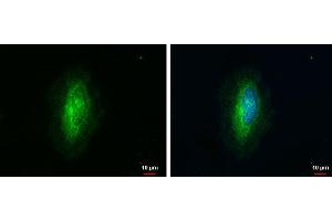 ICC/IF Image ARHGAP1 antibody [N1N3] detects ARHGAP1 protein at cytoplasm by immunofluorescent analysis. (ARHGAP1 抗体  (N-Term))