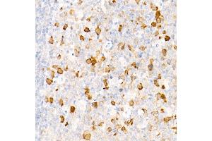 Immunohistochemistry (IHC) image for anti-Chromosome 6 Open Reading Frame 150 (C6orf150) (AA 350-522) antibody (ABIN6143590)