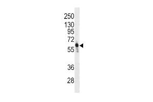 Western blot analysis of anti-PFKFB3 Antibody (C-term) (ABIN392768 and ABIN2842213) in CEM cell line lysates (35 μg/lane). (PFKFB3 抗体  (C-Term))