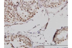 Immunoperoxidase of monoclonal antibody to MLH1 on formalin-fixed paraffin-embedded human testis. (MLH1 抗体  (AA 1-756))