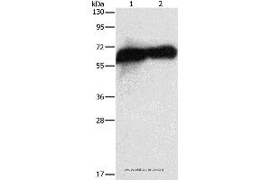 Western blot analysis of HepG2 cell and human placenta tissue, using ALPP Polyclonal Antibody at dilution of 1:1450 (PLAP 抗体)