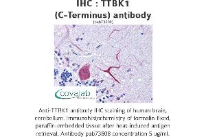 Image no. 1 for anti-tau Tubulin Kinase 1 (Ttbk1) (C-Term) antibody (ABIN1740433) (TTBK1 抗体  (C-Term))
