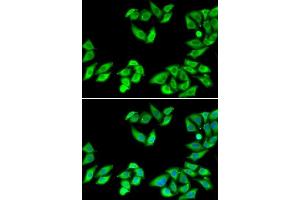 Immunofluorescence analysis of MCF7 cells using RPS14 antibody. (RPS14 抗体  (AA 1-151))