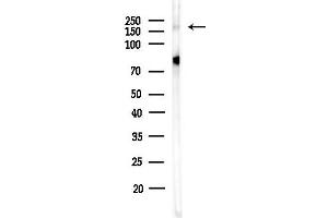 Western blot analysis of lysates from HepG2 cells(heat-shock,45 min treatment), using WHSC1L1 Antibody at 1/1000 dilution.