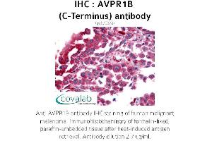 Image no. 1 for anti-Arginine Vasopressin Receptor 1B (AVPR1B) (C-Term) antibody (ABIN1732149) (AVPR1B 抗体  (C-Term))