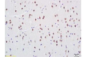Immunohistochemistry (Paraffin-embedded Sections) (IHC (p)) image for anti-Acidic (Leucine-Rich) Nuclear phosphoprotein 32 Family, Member C (ANP32C) (AA 81-180) antibody (ABIN759941)