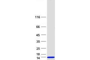 Western Blotting (WB) image for S100 Calcium Binding Protein A12 (S100A12) protein (Myc-DYKDDDDK Tag) (ABIN2731294)