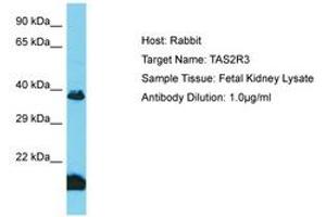 Image no. 1 for anti-Taste Receptor, Type 2, Member 3 (TAS2R3) (AA 129-178) antibody (ABIN6750602) (TAS2R3 抗体  (AA 129-178))