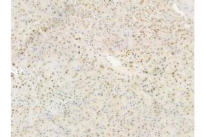 ABIN6254903 and ABIN6267564 at 1/100 staining human normal liver tissue by IHC-P. (Histone H4 抗体  (acLys5))