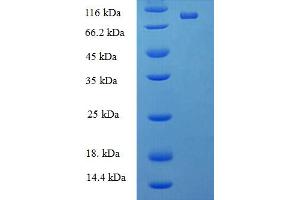 SDS-PAGE (SDS) image for DEAD (Asp-Glu-Ala-As) Box Polypeptide 19A (DDX19A) (AA 1-478), (full length) protein (His-SUMO Tag) (ABIN5711934) (DDX19A Protein (AA 1-478, full length) (His-SUMO Tag))