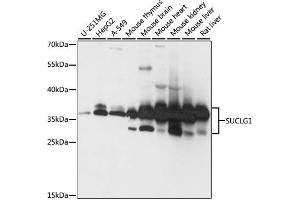 Western blot analysis of extracts of various cell lines, using SUCLG1 antibody. (SUCLG1 抗体)