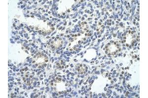 Rabbit Anti-SMARCE1 antibody         Paraffin Embedded Tissue:  Human Lung    cell Cellular Data:  alveolar cell    Antibody Concentration:  4.