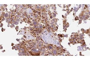 Immunohistochemistry (IHC) image for anti-Collagen, Type I, alpha 2 (COL1A2) (N-Term) antibody (ABIN6258438)