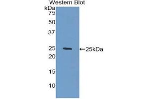 Western Blotting (WB) image for anti-Galactosidase, beta 1 (GLB1) (AA 68-219) antibody (ABIN1172543)