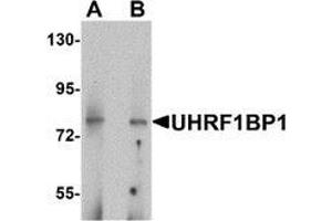 Western blot analysis of UHRF1BP1 in mouse kidney tissue lysate with UHRF1BP1 antibody at (A) 1 and (B) 2 μg/mL
