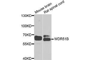 Western blot analysis of extracts of various cell lines, using POC1B antibody (ABIN5974757) at 1/1000 dilution. (POC1B 抗体)