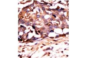 Image no. 1 for anti-Signal Transducer and Activator of Transcription 3 (Acute-Phase Response Factor) (STAT3) (pTyr705) antibody (ABIN358234) (STAT3 抗体  (pTyr705))