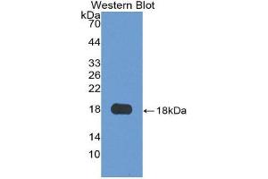 Western Blotting (WB) image for anti-Granulin (GRN) (AA 21-120) antibody (ABIN1175737) (Granulin 抗体  (AA 21-120))