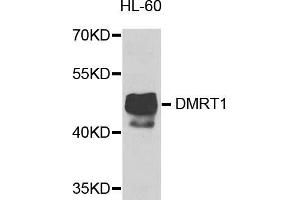 Western blot analysis of extracts of HL-60 cells, using DMRT1 antibody. (DMRT1 抗体)