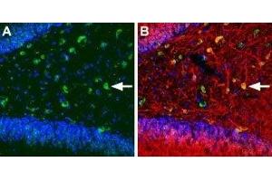 Expression of KCNQ5 in rat hippocampus - Immunohistochemical staining of immersion-fixed, free floating rat brain frozen sections using Anti-KCNQ5 Antibody (ABIN7043507, ABIN7045050 and ABIN7045051), (1:100). (KCNQ5 抗体  (C-Term, Intracellular))